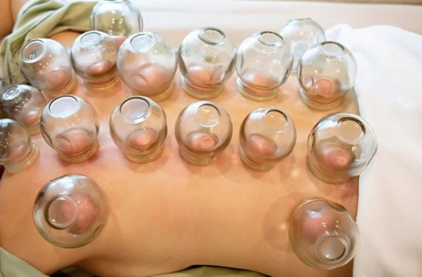 Giác Hơi – Cạo Gió Có Thật Sự Tốt Cho Sức Khỏe?